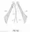Fig. 41 - Suturing devices and methods for suturing an anatomic valve