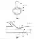 Fig. 07 - APPARATUS FOR BYPASS GRAFT