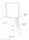 Fig. 09 - Water enucleation of the prostate