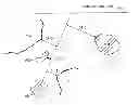 Fig. 01 - PUNCTURE SUPPORT DEVICE