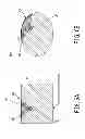Fig. 07 - PUNCTURE SUPPORT DEVICE