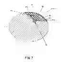 Fig. 08 - PUNCTURE SUPPORT DEVICE