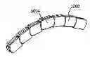 Fig. 01 - ATRAUMATIC STERNAL PLATE