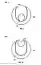 Fig. 07 - Dilation system