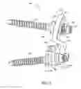 Fig. 04 - Angled washer polyaxial connection for dynamic spine prosthesis