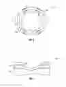 Fig. 04 - Orthopedic fixation devices and methods of installation thereof