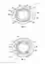 Fig. 06 - Orthopedic fixation devices and methods of installation thereof
