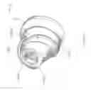 Fig. 30 - Open-architecture interference screw