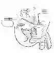Fig. 06 - TREATMENT OF SEXUAL DYSFUNCTION