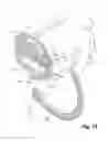 Fig. 10 - Symptom-treatment system