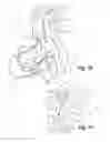Fig. 12 - Symptom-treatment system