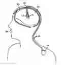 Fig. 01 - Management of stimulation safety limits in a neurostimulation system
