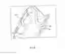 Fig. 06 - Orthosis for a gait modulation system