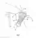 Fig. 07 - Orthosis for a gait modulation system