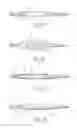 Fig. 02 - Balloon catheter with stent and method for manufacturing it