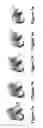 Fig. 06 - Method for determining contact position parameters of a joint connecting two bones