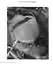 Fig. 02 - Peach tree named 'FA 1566'