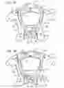 Fig. 08 - Child containment system with multiple infant support modes