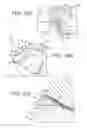 Fig. 09 - Method and system for turning and positioning a patient