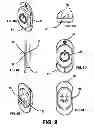 Fig. 09 - Ticket scraping device