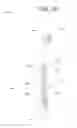 Fig. 07 - BLING TOOTHBRUSH