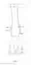 Fig. 07 - Equine protective boot