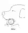 Fig. 04 - Breathable retrieving device
