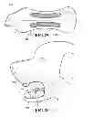 Fig. 13 - Breathable retrieving device