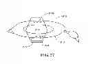 Fig. 14 - Breathable retrieving device