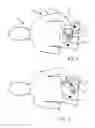 Fig. 02 - FIXTURE FOR IMMOBILIZING AN ARM OF A PATIENT