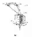 Fig. 02 - Coil Tube Injector System