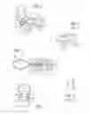 Fig. 02 - Pull out earplug