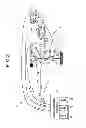 Fig. 08 - Apparatus for supporting and following movement of a part of person's body