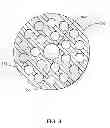 Fig. 04 - Particulate superabsorbent polymer composition having improved stability