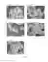 Fig. 07 - Rare earth phosphovanadate phosphor and method for producing the same