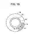 Fig. 03 - Ophthalmic lens assembly having an integrated antenna structure