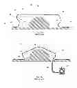 Fig. 03 - Vacuum forming regulator bag