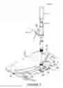 Fig. 09 - Handle cart