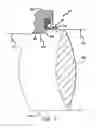 Fig. 07 - Train axle assembly