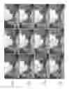 Fig. 12 - Stereoscopic panoramas