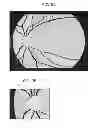 Fig. 09 - Ophthalmologic apparatus, method for controlling ophthalmologic apparatus, and program