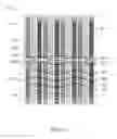 Fig. 09 - Self aligning imager array