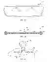 Fig. 23 - Clear bezel