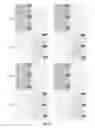 Fig. 09 - METHOD FOR LINKAGE RESOURCE ASSIGNMENT, UE, METHOD FOR MULTIPLEXING TRANSMISSION AND ENB