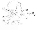 Fig. 01 - HEADSET SYSTEM WITH MICROPHONE FOR AMBIENT SOUNDS