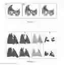 Fig. 03 - Method of assessing heterogeneity in images