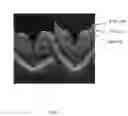 Fig. 05 - Methods to reduce variance in OCT analysis of the macula