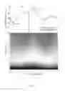 Fig. 09 - Methods to reduce variance in OCT analysis of the macula