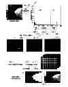 Fig. 01 - Methods, apparatuses, and computer program products for identifying a region of interest within a mammogram image