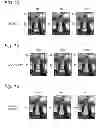 Fig. 14 - Image processing apparatus and method for generating a high resolution image